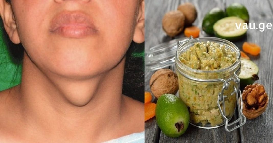 karabadini karabadini