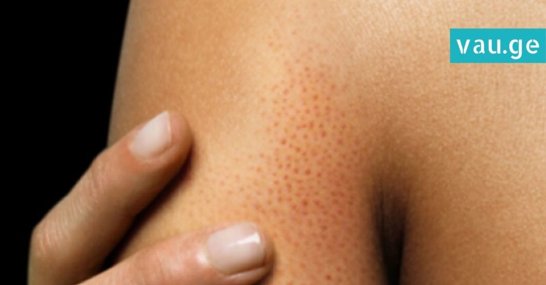 karabadini karabadini