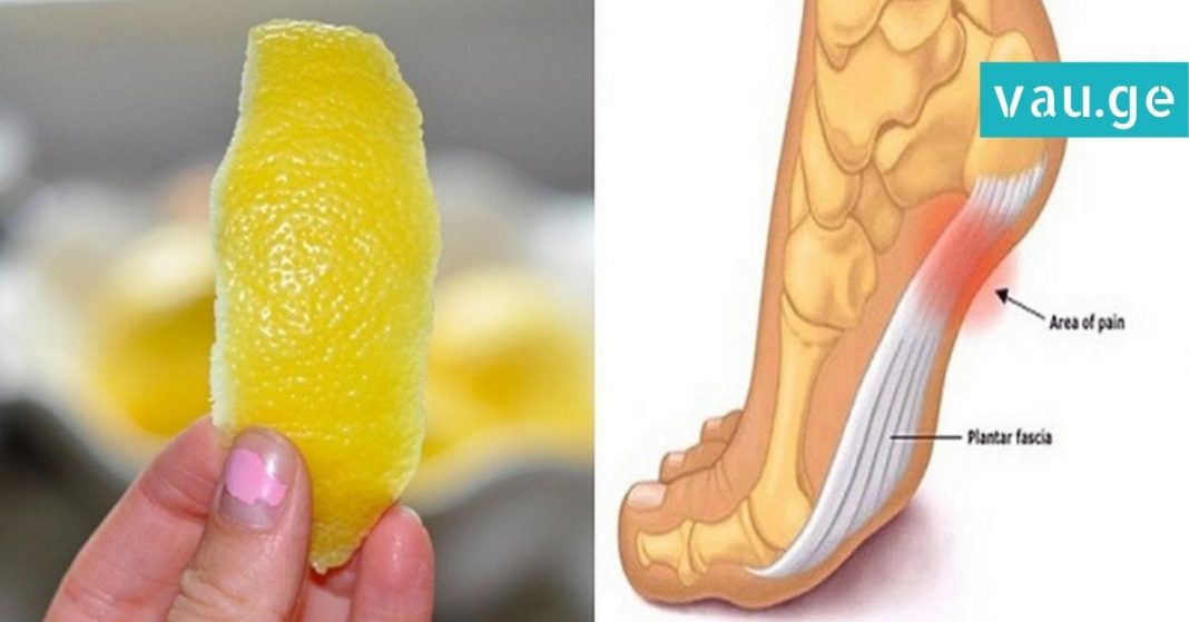 karabadini karabadini