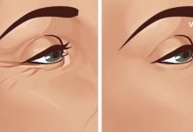 How to Naturally Get Rid of Wrinkles Around the Eyes at Home karabadini