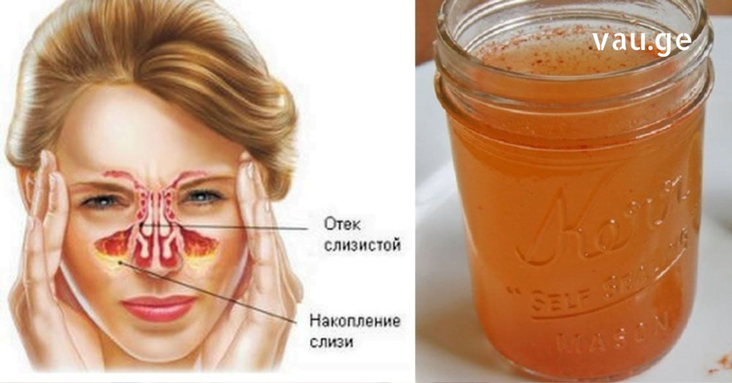 karabadini karabadini