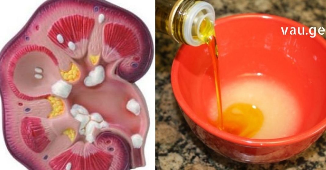 karabadini karabadini