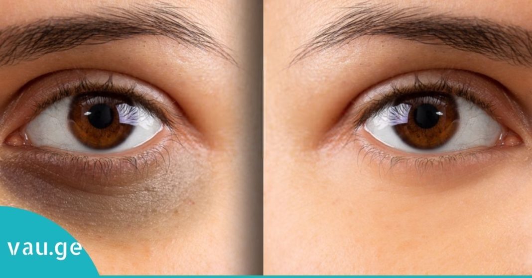 karabadini karabadini