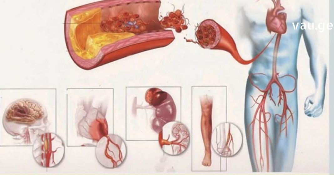 karabadini karabadini