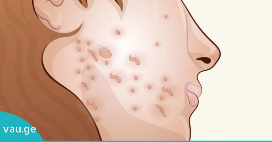 karabadini karabadini