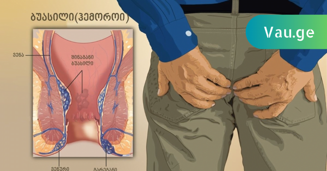 karabadini karabadini