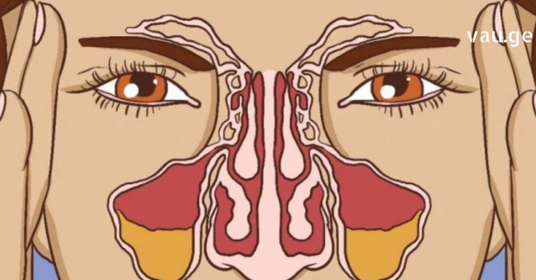 karabadini karabadini