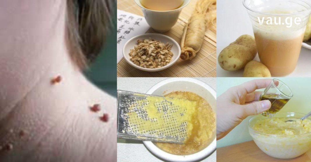 karabadini karabadini