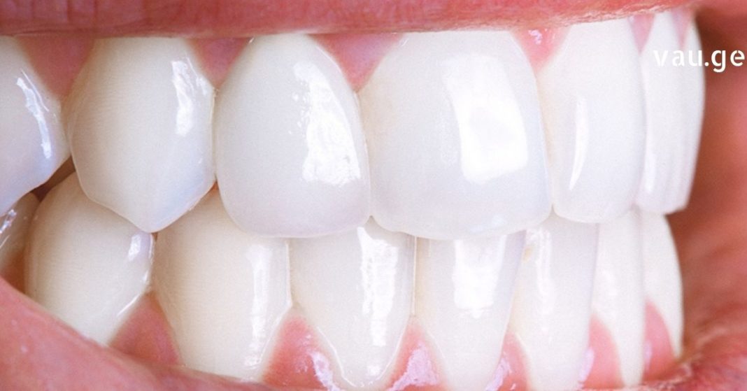 karabadini karabadini