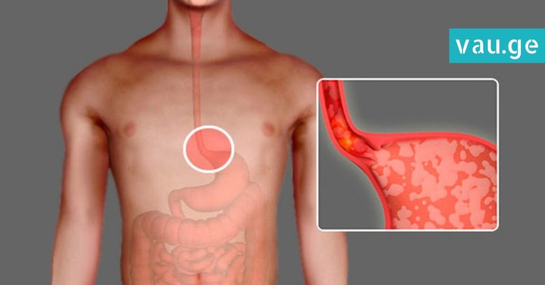 karabadini karabadini