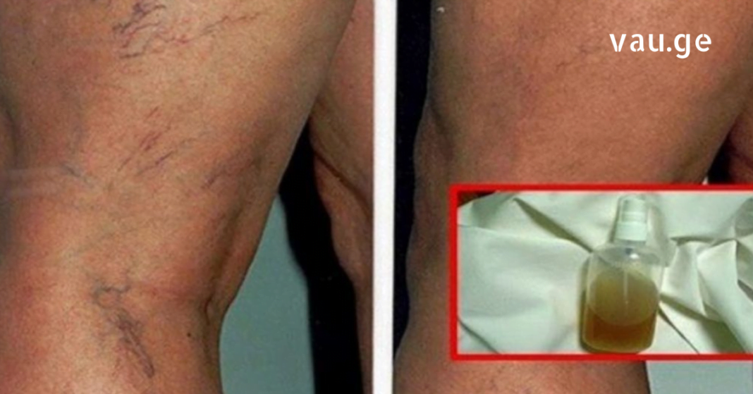 karabadini karabadini