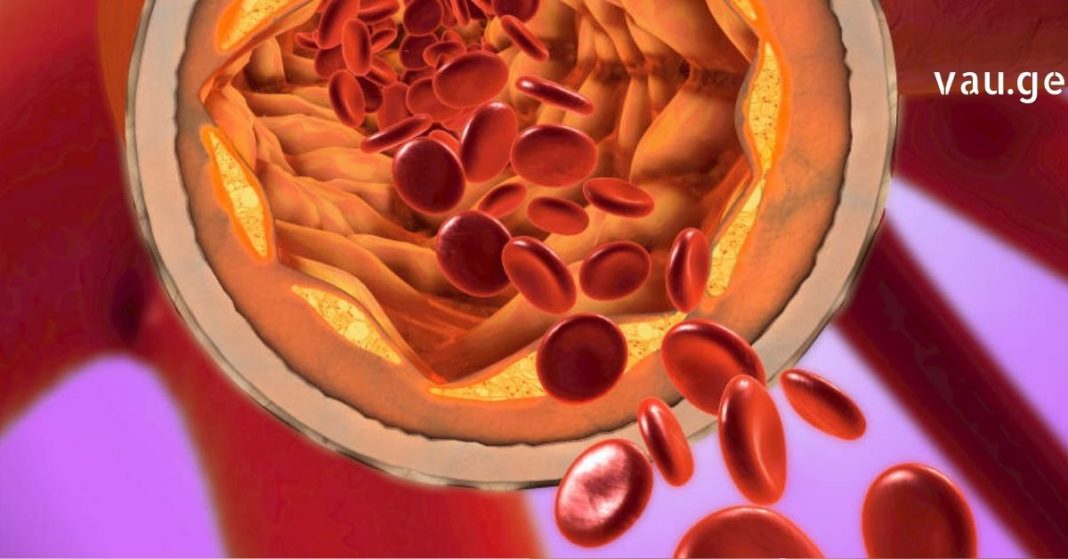 karabadini karabadini