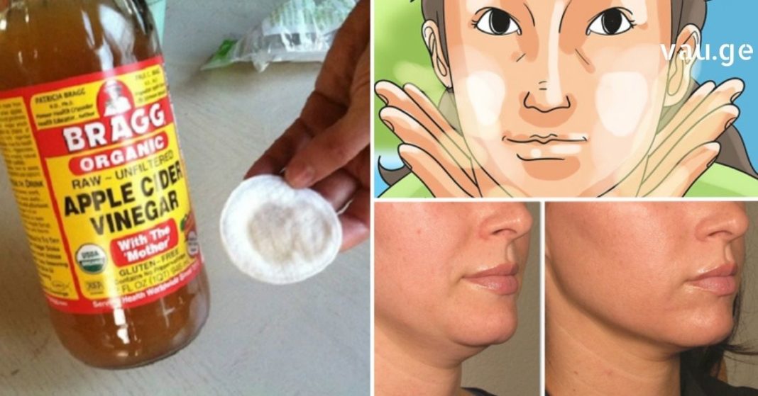 karabadini karabadini