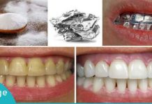 The Strangest Yet Most Effective Method for Whitening Teeth at Home karabadini
