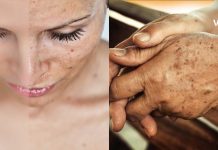 Four of the Best Masks for Removing Pigmentation Spots — Recommended by a Professional Cosmetologist karabadini