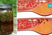 Dill, Honey, and Valerian – Prepare the Ultimate Remedy for Healthy Blood Vessels! karabadini
