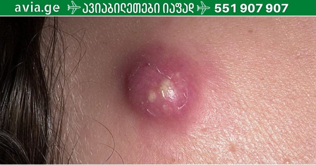 ana xalxuri - 2026-01-04T191712.080 (1)